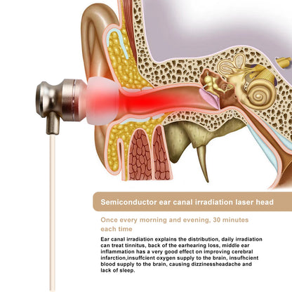 SonoLite Tinnitus Relief Laser Pods