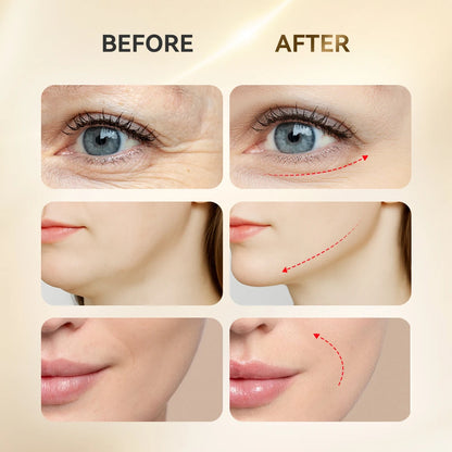 Facial Acupoint Massager